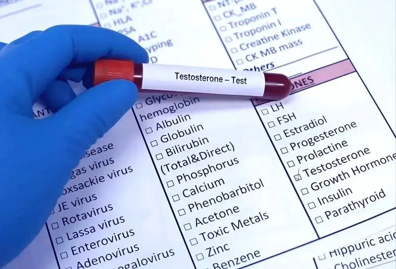 Czy bieganie może przyczynić się do wzrostu poziomu testosteronu?