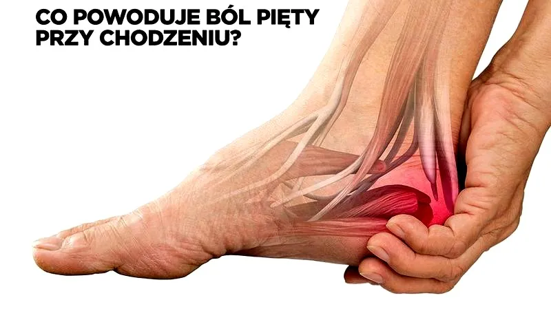 Jak skutecznie wyleczyć ból pięty po bieganiu? Sprawdź nasze sprawdzone metody!