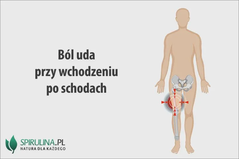 Bieganie a uda