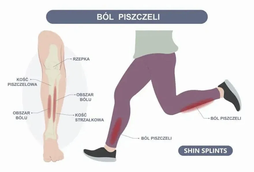 Bieganie bez bólu
