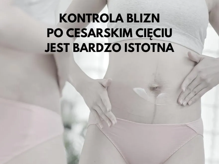 Przygotowanie do biegania
